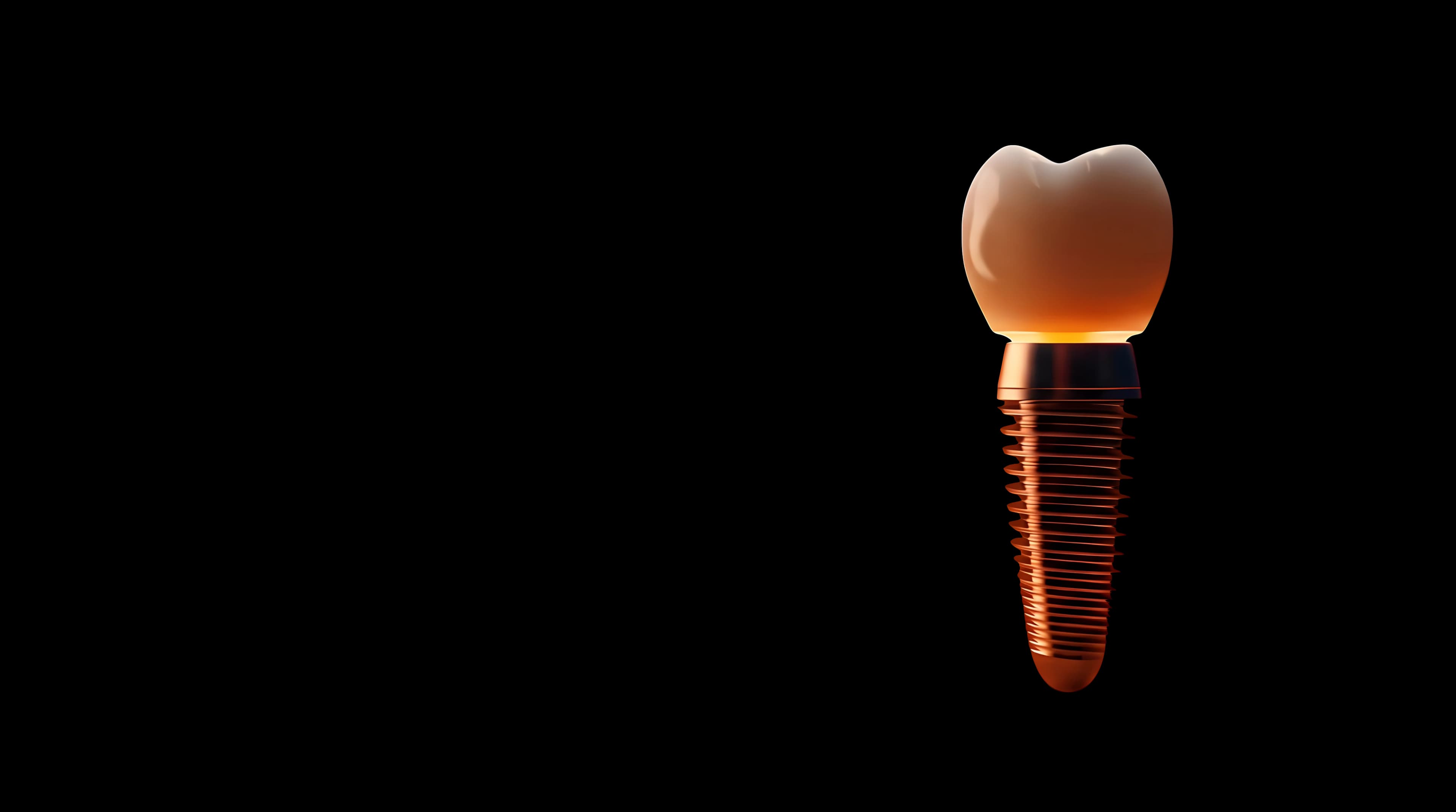 A dental implant, shown in detail